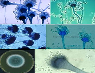 aspergillus