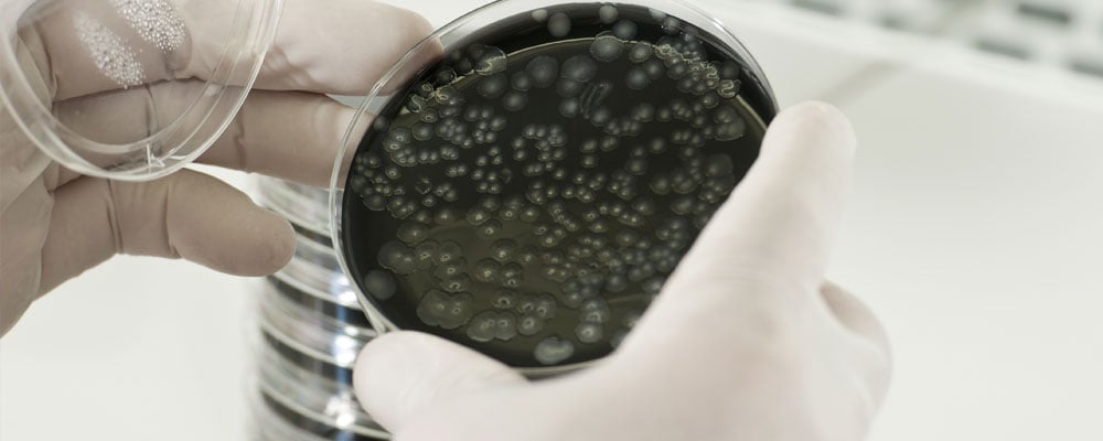 A sample of Legionella, an infectious bacterium that needs to be addressed in healthcare infection control protocol.